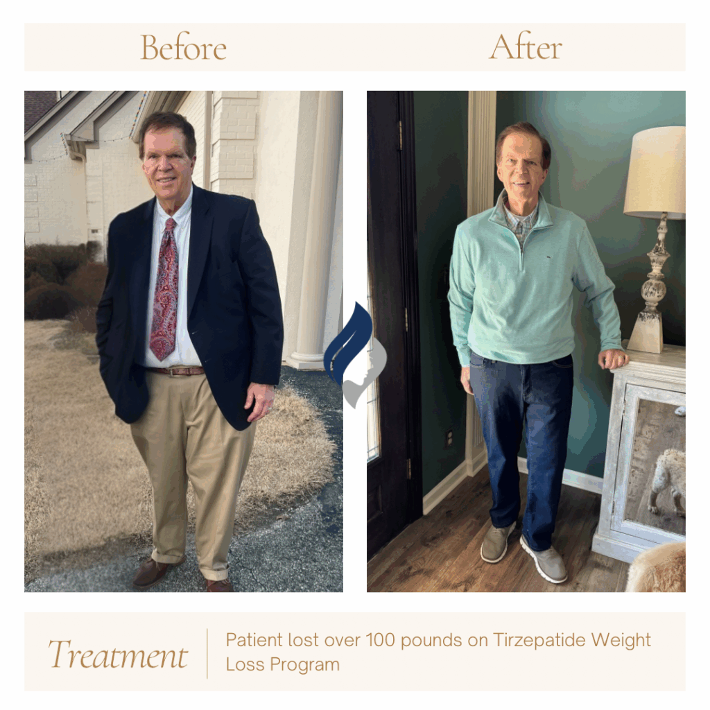 Patient lost 100 pounds on tirzepatide and has maintained for a year!
